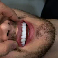 کامپوزیت از ۱ تومن با ضمانت ۲ سال