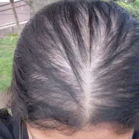 محلول هیراستار