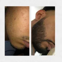 دیگه تیغ نزن
