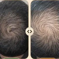 کبدچرب|آرایشی، بهداشتی، درمانی|مشهد, سناباد|دیوار