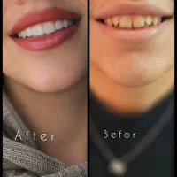 مرکز دندانپزشکی اسپی دنتال