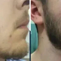 درمانتو ریشه رقم میزنیم