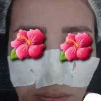 فیشال تخصصی باتخفیف ویژه