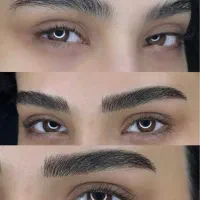 میکروبلیدینگ سوپرنچرال با پترن اختصاصی