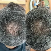 اگه اینکارو بکنی هر هفته باید موهات رو کوتاه کنی