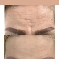 آموزش تخصصی فیشیال پوست ویژه بانوان در کلینیک