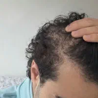 رویش دوباره رویا نیست علم است