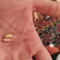 ب دلیل مقررات برنامه دیوار نمیتونم اسمشو بنویسم