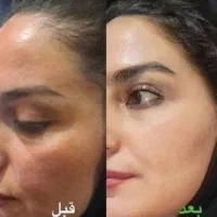 کرم سفیدکننده اِلا