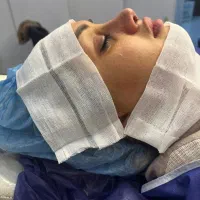 بینی|خدمات زیبایی و سلامت|دهدشت, |دیوار