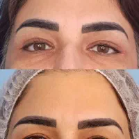 عمل های جراحی زیبایی توسط فوق  تخصص پلاستیک