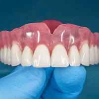 لابراتوار و دندانسازی سیارتحویل۲روزکاری فقط(اقساط)