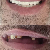 تخفیفات ویژه دندانپزشکی و دندانسازی