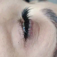 لیفت وکاشت هیدن وکاشت موقت