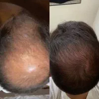 موهات اینقدر زیاد میشه که نمیتونی جلوشو بگیری