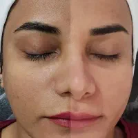 پاکسازی پوست ۵۰۰