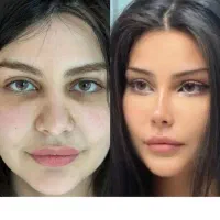 جشنواره زیبای کل صورت و بدن با تیم مجرب پزشکی
