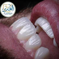 دندانپزشکی تضمین قیمت تقسیط بدون سود
