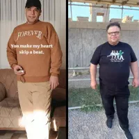 جراحی اسلیو معده ، مشاوره و بررسی رایگان|خدمات آرایشگری و زیبایی|تهران, نیاوران|دیوار