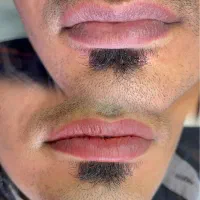 اصلاح رنگ لب آقایان