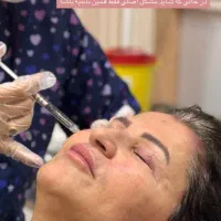 تخفیفات استثنایی کلینیک‌ زیبایی ونوس