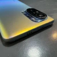 Mi 11 i