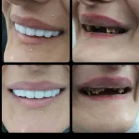 کلیه خدمات دندانپزشکی اقساط بدون سود