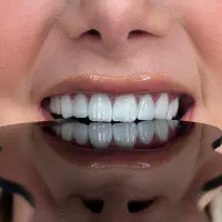 دندانپزشکی و روکش و دندان مصنوعی با شرایط اقساطی