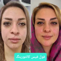 کلینیک زیبایی بوتاکس ژل فیلر بادی نخ لیزر لاغری