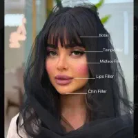 تزریق دقیق ژل،فیلر،bt مزو.فشیال وprpزاویه سازی