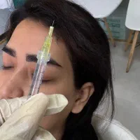 متخصص درمان در prp، مزوتراپی ،لیزر ،جوانساز و غیره
