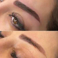 تخفیف ویژه اموزش وخدمات  فیبروز ابرو