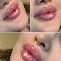 حجامت بادکش امبدینگ پی آرپی مزو تراپی هایفو لاغری