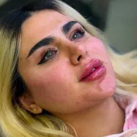 ژل و بوتاکس سیسی 1200