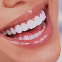 لمینت دندان / ایمپلنت / مشاوره رایگان /اقساطی /