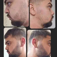 متد.جدید.رویش.34روزه