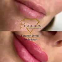 ارائه خدمات تخصصی شیدینگ ورفع تیرگی لب