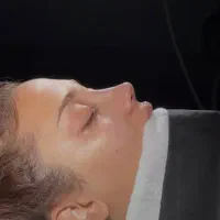 جراحی بینی عمل بینی بلفارو ساکشن غبغب لیفت لیپو