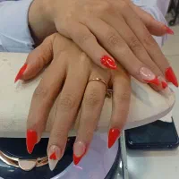 مدل رایگان کاشت و ترمیم