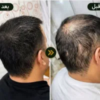 گیاهی و بدون عوارض