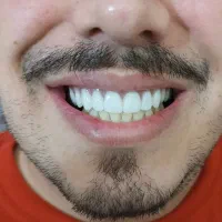 بهترین خدمات دندان و دندان مصنوعی،تربت حیدریه