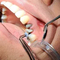 دندانپزشکی ، تخفیف بهمراه کیفیت