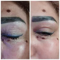 خالبرداری ، حجامت ...تضمینی