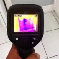 لوله بازکنی 25%تخفیف واقعی رفع نمزدگی با لیزر