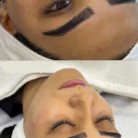 فیشیال تخصصی غیر تهاجمی