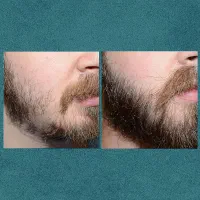 معجزه|آرایشی، بهداشتی، درمانی|خوی, |دیوار