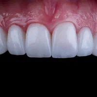 دندانپزشکی تخصصی بصورت تضمینی و اقساطی