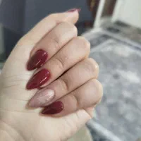 کاشت ناخن اشتهارد