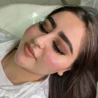 مدل فیلر و بوتاکس