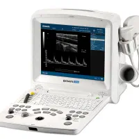دستگاه سونوگرافی پرتابل dus 60